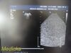 PHILIPS S5-1 P/N 21314A Sector Array Ultrasound Transducer