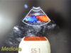 PHILIPS S5-1 P/N 21314A Sector Array Ultrasound Transducer