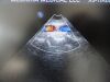 PHILIPS X3-1 P/N 21715A xMatrix Phased Array Ultrasound Transducer