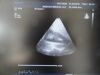 PHILIPS X3-1 P/N 21715A xMatrix Phased Array Ultrasound Transducer