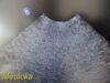PHILIPS X6-1 Phased Array Ultrasound Transducer