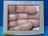 NATIONAL DISPLAY SYSTEMS National Display System V3C-SX18-A173 18" Medical Display Monitor