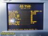 ASPECT MEDICAL 2007  A-2000 Bis-XP Monitor