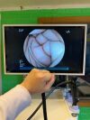 FUJINON EC-530WL Colonoscope