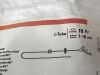 AVANOS MIC JeJunal Feeding Tube  020-18   Exp.2024-07  (F2) MIC JeJunal Feeding Tube
