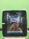GE Venue 40 Ultrasound Machine