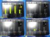 INTEGRA 2012  CUSA Excel 2 Ultrasonic Surgical Aspiration Console ONLY