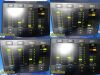 INTEGRA 2012  CUSA Excel 2 Ultrasonic Surgical Aspiration Console ONLY