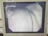 OLYMPUS TJF-Q180V Video Duodenoscope Endoscope