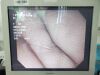 OLYMPUS TJF-Q180V Video Duodenoscope Endoscope