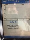 DRAEGER Evita 4 edition Ventilator