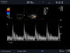 ALOKA UST-676P Ultrasound Transducer