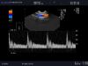 ALOKA UST-9118 Ultrasound Transducer