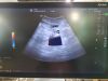 GE Logiq S8 XDclear Ultrasound System (Year: 2017)