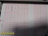 GE 116 Series Model 0116 Fetal Monitor