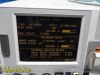 GE 120 Series Model 0128 Maternal Fetal Monitor W/ US & TOCO Transducers