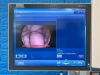 KARL STORZ H3-Z Laparoscope