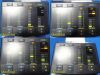 INTEGRA 2010  CUSA Excel 2 US Aspiration Console W/ 23Khz Handpiece