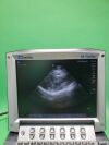 SONOSITE P21x Ultrasound Transducer Probe
