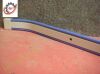 HILL-ROM 14531401-NEB Siderail Extrusion Bumper Gard Kit Stretcher