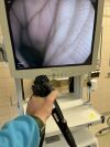 PENTAX EC-3890FK2 Colonoscope