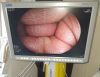 FUJINON EC-530WL Colonoscope