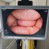 FUJINON EC-530WL Colonoscope