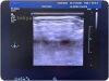 PHILIPS L9-3 LINEAR Ultrasound Transducer