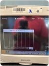 PHILIPS MP50 M8004A Anesthesia Monitor