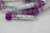 New GREINER K2EDTA Bio-One VACUETTE Blood Collection Tubes 4ml 50ct ...