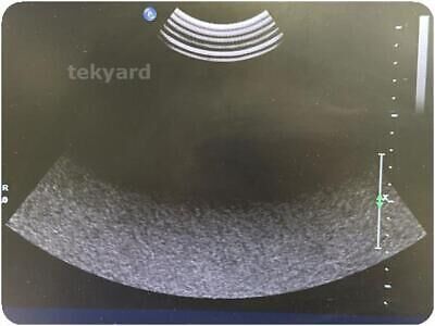 PHILIPS CURVED Ultrasound Transducer