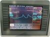 GE DASH 2000 BP Monitor