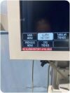 GE LCD ECG unit