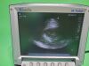 SONOSITE P21x/5-1 MHz Probe Ultrasound Transducer