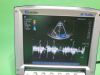 SONOSITE P21x/5-1 MHz Probe Ultrasound Transducer