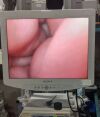 OLYMPUS LTF Type V3 Laparoscope