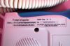 SONOLIFE Fetal Doppler Neonatal Monitor
