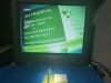 OLYMPUS LTF-VP Laparoscope