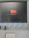 SONOSITE S-NERVE Portable Ultrasound System