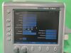 SONOSITE S-NERVE Portable Ultrasound System