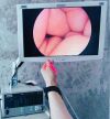 KARL STORZ Image 1 Hub Stack System Endoscopy System