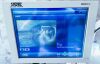 KARL STORZ Image 1 Hub Stack System Endoscopy System