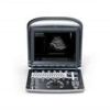 CHISON ECO 1 Portable System Ultrasound - Shared Service