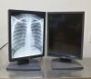 BARCO Lot of 2  Coronis MDCG 2121 Diagnostic Grayscale Display System - 181951 Monitor
