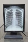 BARCO Lot of 2  Coronis MDCG 2121 Diagnostic Grayscale Display System - 181951 Monitor