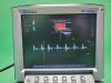SONOSITE M-Turbo Ultrasound System