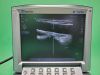 SONOSITE M-Turbo Ultrasound System