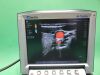 SONOSITE M-Turbo Ultrasound System