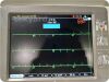 GE MARQUETTE Mac 5000 Resting EKG System / ECG unit