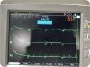 GE MARQUETTE Mac 5000 Resting EKG System / ECG unit